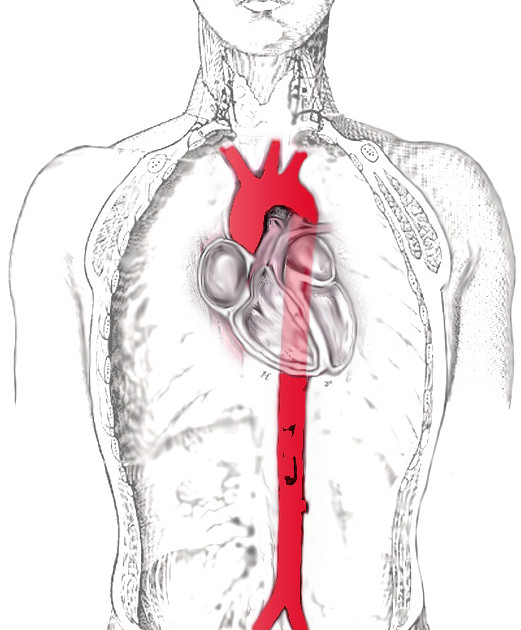 ᐈ 5 найбільших артерій в організмі людини - великі людські артерії - самі великі і головні артерії 2024