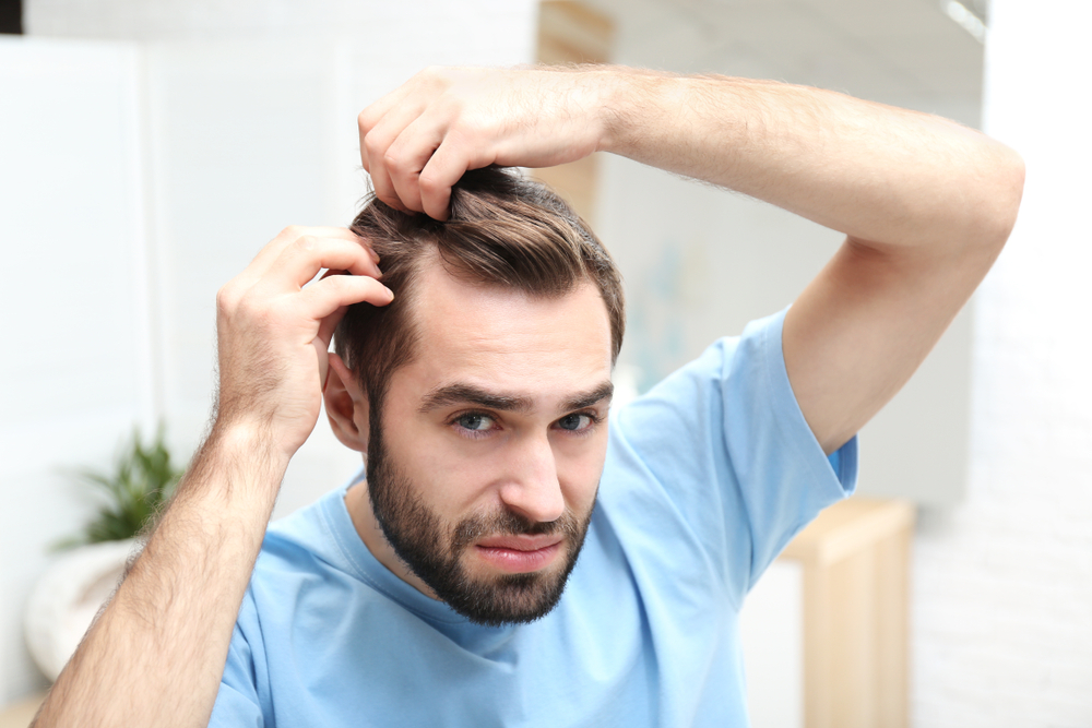 Випадання волосся - Як лікувати випадання волосся на скронях?