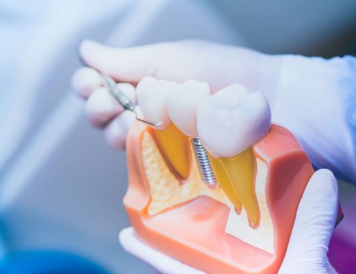 Удаление корня зуба: важность обращения к опытным специалистам