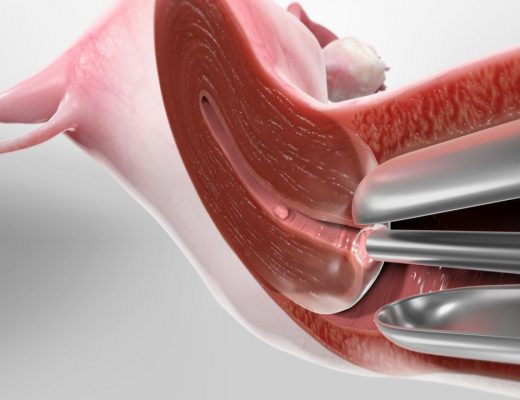 Гістероскопія у Києві при безплідді: сучасні методи обстеження та лікування
