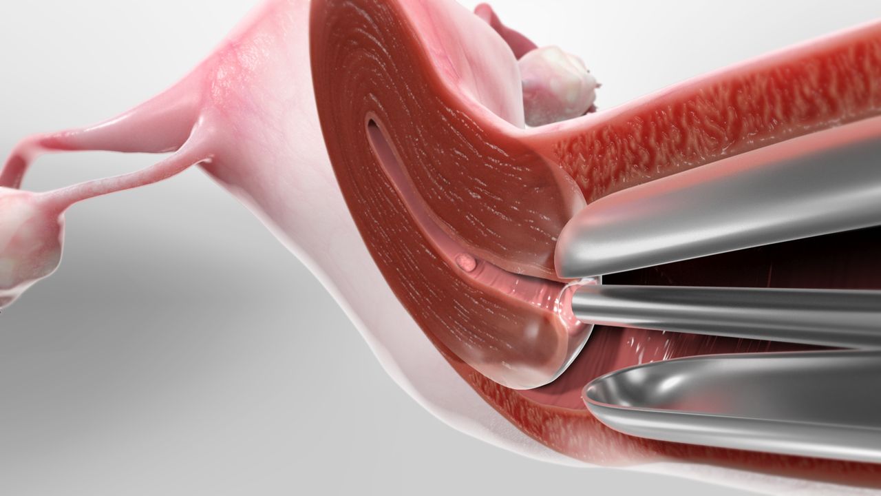 Гістероскопія у Києві при безплідді: сучасні методи обстеження та лікування